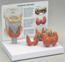 Thyroid Pharmaceutical and Anatomical Model Gifts